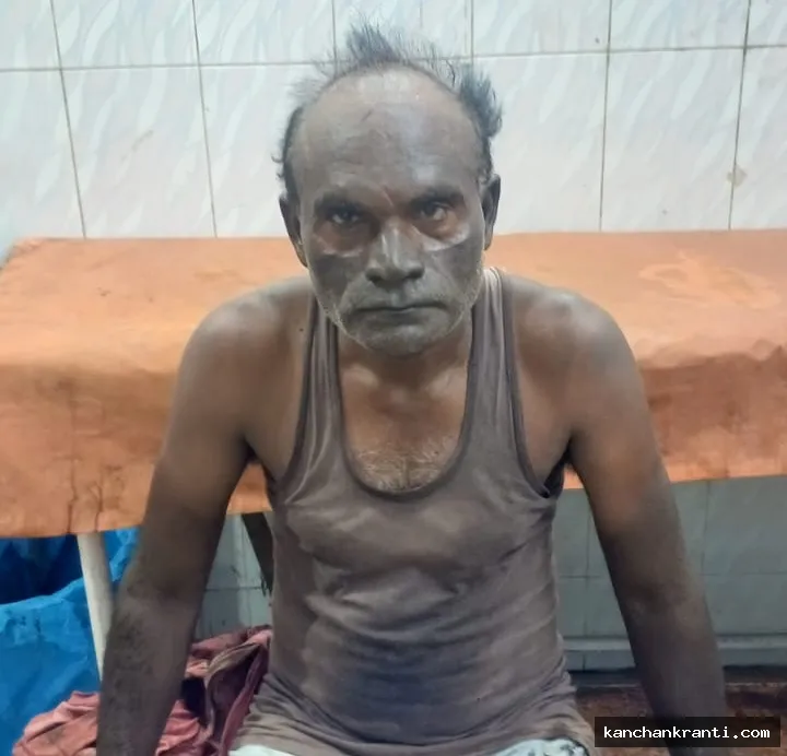 BREAKING: बीसीसीएल पाथरडीह की निर्माणाधीन वाशरी में बड़ा हादसा:  वेल्डिंग मशीन फटने से 3 मजदूर झुलसे, 1 की हालत गंभीर