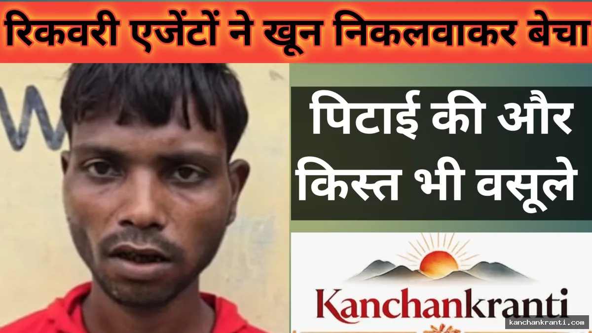 लखनऊ में रिकवरी एजेंटों की हैवानियत: युवक को अगवा कर 4 दिन पीटा, 1 यूनिट खून निकलवाकर बेचा, किस्त भी वसूली