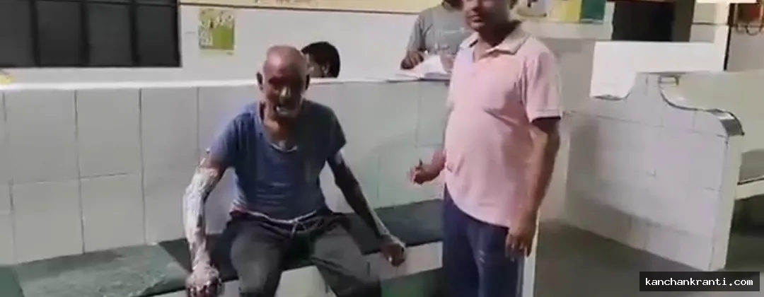 संदिग्ध परिस्थितियों में मकान में लगी भीषण आग, पति-पत्नी और बेटा गंभीर रूप से झुलसे